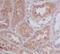 Apolipoprotein E antibody, M00015, Boster Biological Technology, Immunohistochemistry paraffin image 