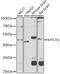 Mitochondrial Carrier 1 antibody, A09592, Boster Biological Technology, Western Blot image 