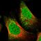 Trinucleotide Repeat Containing 18 antibody, HPA024251, Atlas Antibodies, Immunofluorescence image 