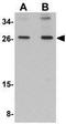 Secretory Carrier Membrane Protein 4 antibody, GTX85261, GeneTex, Western Blot image 