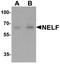 NMDA Receptor Synaptonuclear Signaling And Neuronal Migration Factor antibody, A08385, Boster Biological Technology, Western Blot image 