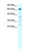 Poly(ADP-Ribose) Polymerase Family Member 3 antibody, orb329745, Biorbyt, Western Blot image 
