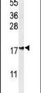 Inner Mitochondrial Membrane Peptidase Subunit 2 antibody, PA5-26991, Invitrogen Antibodies, Western Blot image 