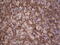 Dicer 1, Ribonuclease III antibody, M00190, Boster Biological Technology, Immunohistochemistry paraffin image 