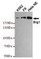 SWI/SNF Related, Matrix Associated, Actin Dependent Regulator Of Chromatin, Subfamily A, Member 4 antibody, MBS475232, MyBioSource, Western Blot image 