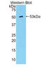 Kallikrein Related Peptidase 8 antibody, LS-C294981, Lifespan Biosciences, Western Blot image 