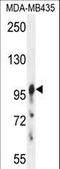 Axin 1 antibody, LS-C156697, Lifespan Biosciences, Western Blot image 