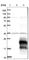 Baculoviral IAP repeat-containing protein 5 antibody, HPA002830, Atlas Antibodies, Western Blot image 