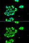 RAD51 Paralog D antibody, GTX64591, GeneTex, Immunofluorescence image 