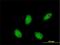 Retinoid X Receptor Alpha antibody, H00006256-M07, Novus Biologicals, Immunofluorescence image 