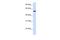 PHD Finger Protein 10 antibody, A08195, Boster Biological Technology, Western Blot image 