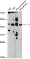 Syntaxin 18 antibody, 15-507, ProSci, Western Blot image 