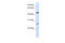 Transmembrane protein 127 antibody, 26-211, ProSci, Enzyme Linked Immunosorbent Assay image 