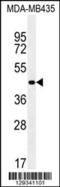 Zinc Finger Protein 625 antibody, 55-880, ProSci, Western Blot image 
