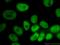 Nudix Hydrolase 21 antibody, 66335-1-Ig, Proteintech Group, Immunofluorescence image 