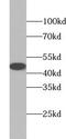 Acyl-CoA Dehydrogenase Medium Chain antibody, FNab00065, FineTest, Western Blot image 