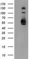 Sorting Nexin 8 antibody, CF502136, Origene, Western Blot image 