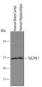Sulfotransferase Family 4A Member 1 antibody, AF5826, R&D Systems, Western Blot image 