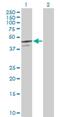 Serpin Family B Member 7 antibody, H00008710-D01P, Novus Biologicals, Western Blot image 