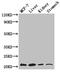 Glucosamine-Phosphate N-Acetyltransferase 1 antibody, CSB-PA856926LA01HU, Cusabio, Western Blot image 