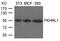 Forkhead Box O3 antibody, GTX50856, GeneTex, Western Blot image 