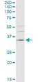 Carbonic Anhydrase 4 antibody, H00000762-M08, Novus Biologicals, Western Blot image 