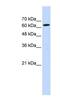 Eukaryotic Translation Initiation Factor 2D antibody, NBP1-57395, Novus Biologicals, Western Blot image 