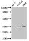 MAGE Family Member A3 antibody, LS-C675135, Lifespan Biosciences, Western Blot image 