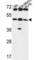 UDP-GlcNAc:BetaGal Beta-1,3-N-Acetylglucosaminyltransferase 5 antibody, abx034455, Abbexa, Western Blot image 