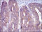 Cbl Proto-Oncogene antibody, M00152, Boster Biological Technology, Immunohistochemistry paraffin image 