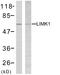 LIM Domain Kinase 2 antibody, LS-C118172, Lifespan Biosciences, Western Blot image 