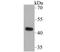 Ubiquinol-Cytochrome C Reductase Core Protein 2 antibody, NBP2-76971, Novus Biologicals, Western Blot image 