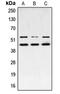 Mitogen-Activated Protein Kinase 8 antibody, GTX34387, GeneTex, Western Blot image 