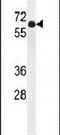 Beta,beta-carotene 9 ,10 -oxygenase antibody, PA5-24527, Invitrogen Antibodies, Western Blot image 