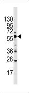 Golgi Associated PDZ And Coiled-Coil Motif Containing antibody, LS-C100820, Lifespan Biosciences, Western Blot image 