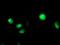 Cytochrome P450 2C9 antibody, NBP2-01397, Novus Biologicals, Immunocytochemistry image 