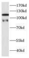 DnaJ Heat Shock Protein Family (Hsp40) Member C6 antibody, FNab02468, FineTest, Western Blot image 