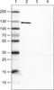 Cadherin 1 antibody, NBP2-34475, Novus Biologicals, Western Blot image 