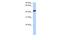 Keratin 23 antibody, A12673, Boster Biological Technology, Western Blot image 