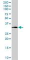 Estrogen Receptor Binding Site Associated Antigen 9 antibody, H00009166-M04, Novus Biologicals, Western Blot image 