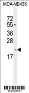 Killin, P53 Regulated DNA Replication Inhibitor antibody, 55-947, ProSci, Western Blot image 