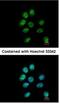 Zinc Finger Protein 143 antibody, NBP1-32104, Novus Biologicals, Immunofluorescence image 