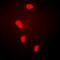 Four And A Half LIM Domains 1 antibody, abx141754, Abbexa, Western Blot image 