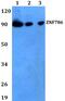 Zinc Finger Protein 786 antibody, PA5-75789, Invitrogen Antibodies, Western Blot image 