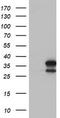 Lactamase Beta 2 antibody, TA502586S, Origene, Western Blot image 