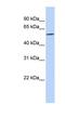 Solute Carrier Family 49 Member 4 antibody, NBP1-59634, Novus Biologicals, Western Blot image 