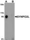 Synaptopodin 2 Like antibody, LS-C144291, Lifespan Biosciences, Western Blot image 