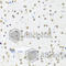 SET Nuclear Proto-Oncogene antibody, A6212, ABclonal Technology, Immunohistochemistry paraffin image 