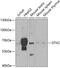 Deltex E3 Ubiquitin Ligase 2 antibody, 22-913, ProSci, Western Blot image 