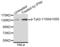 Tyrosine Kinase 2 antibody, STJ113493, St John